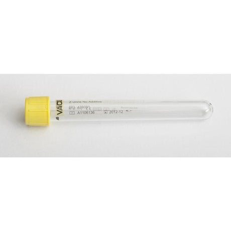 Test tube VACUETTE Yellow Urine 7/6,5ml 50/pack